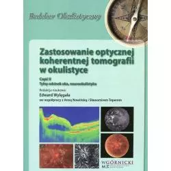 ZASTOSOWANIE OPTYCZNEJ KOHERENTNEJ TOMOGRAFII W OKULISTYCE 2 TYLNY ODCINEK OKA NEUROOKULISTYKA - Górnicki Wydawnictwo Medyczne