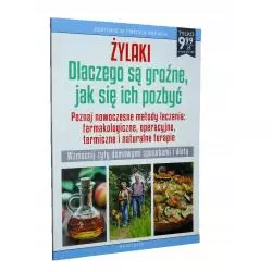 ŻYLAKI DLACZEGO SĄ GROŹNE JAK SIĘ ICH POZBYĆ - Ringier Axel Springer