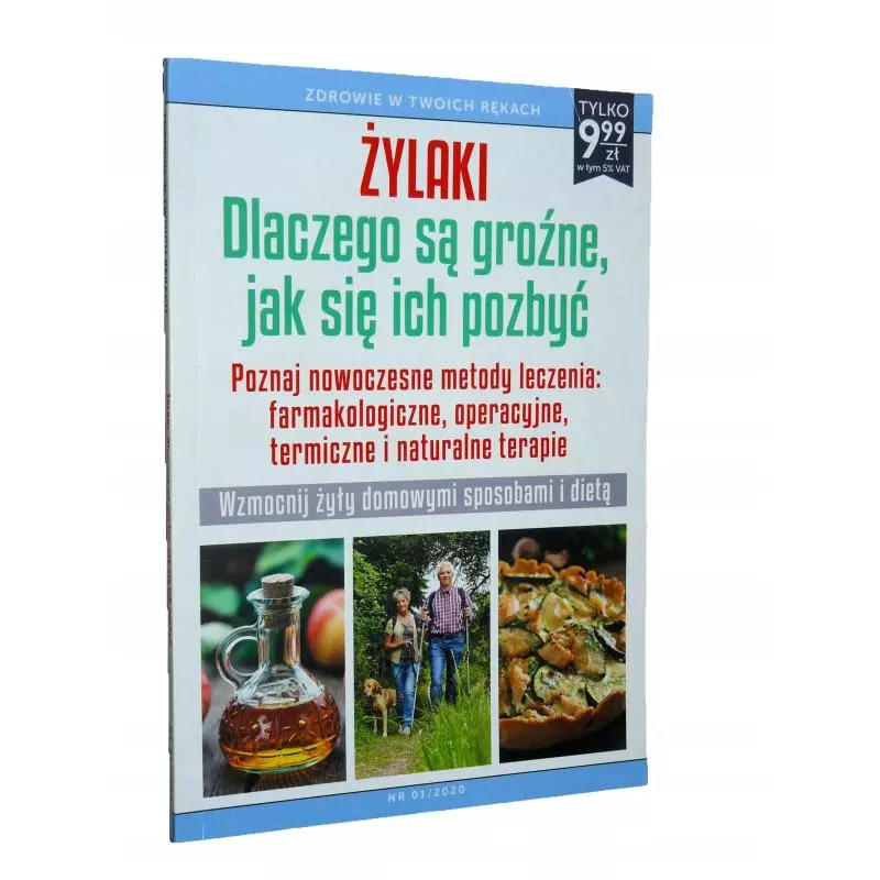 ŻYLAKI DLACZEGO SĄ GROŹNE JAK SIĘ ICH POZBYĆ - Ringier Axel Springer