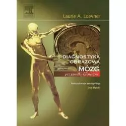 MÓZG DIAGNOSTYKA OBRAZOWA PRZYPADKI KLINICZNE Laurie Loewner - Elsevier Urban&Partner