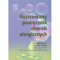 ILUSTROWANY PODRĘCZNIK CHORÓB ALERGICZNYCH Gerhard Grevers - Elsevier Urban&Partner