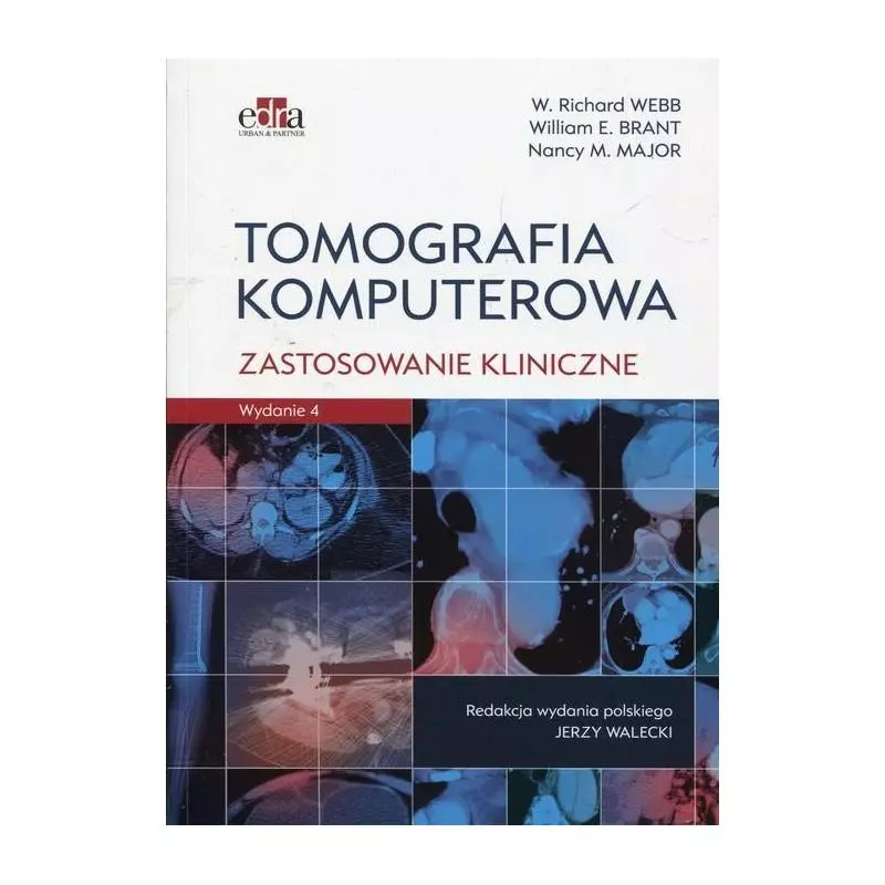 TOMOGRAFIA KOMPUTEROWA ZASTOSOWANIE KLINICZNE Richard Webb - Edra Urban & Partner