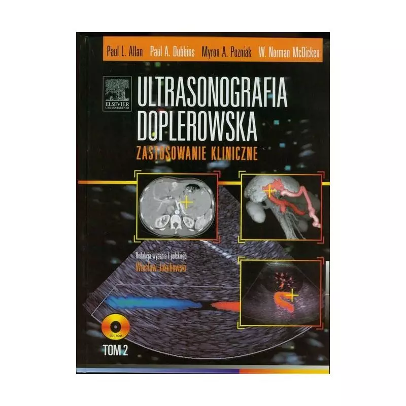 ULTRASONOGRAFIA DOPLEROWSKA ZASTOSOWANIA KLINICZNE 2 Z PŁYTĄ DVD Paul Allan - Elsevier Urban&Partner