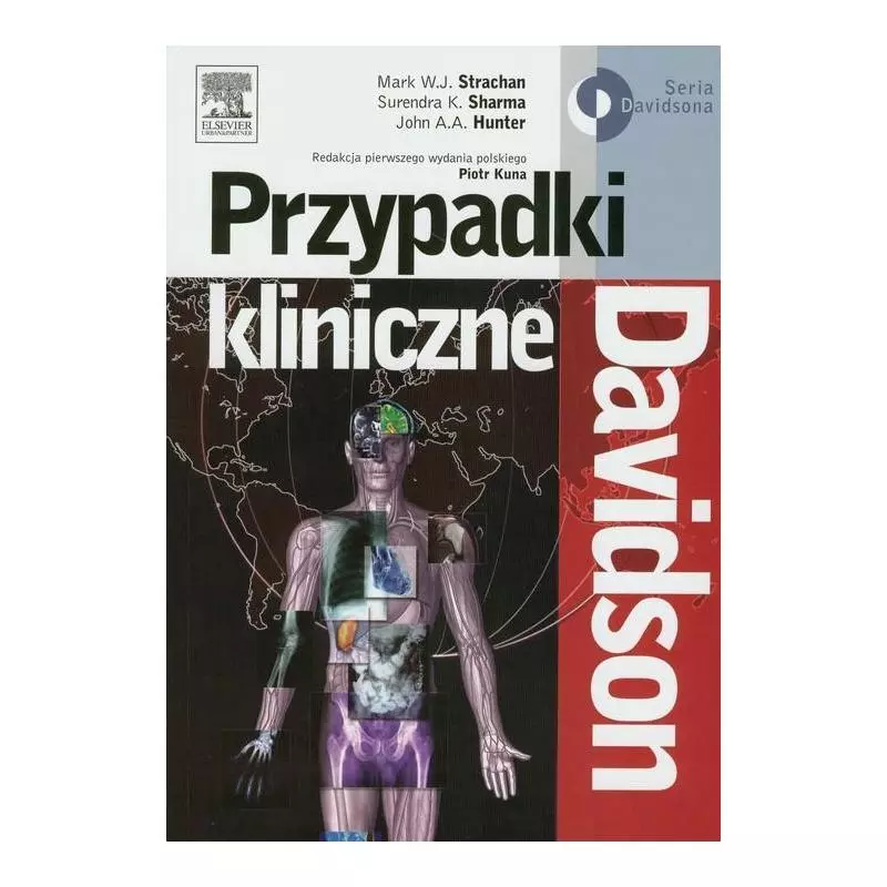 DAVIDSON PRZYPADKI KLINICZNE Mark W.J. Strachan, Surendra K. Sharma, John A.A. Hunter - Elsevier Urban&Partner