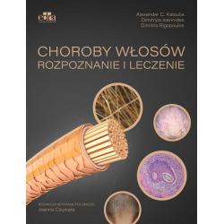 CHOROBY WŁOSÓW. ROZPOZNANIE I LECZENIE