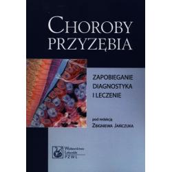 CHOROBY PRZYZĘBIA. ZAPOBIEGANIE, DIAGNOSTYKA, LECZENIE