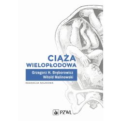 CIĄŻA WIELOPŁODOWA