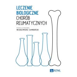 LECZENIE BIOLOGICZNE CHORÓB REUMATYCZNYCH