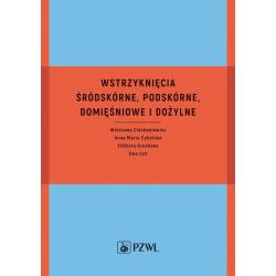 WSTRZYKNIĘCIA ŚRÓDSKÓRNE PODSKÓRNE DOMIĘŚNIOWE I DOŻYLNE