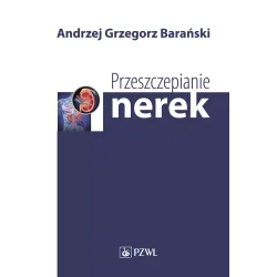 PRZESZCZEPIANIE NEREK