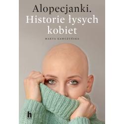ALOPECJANKI. HISTORIE ŁYSYCH KOBIET