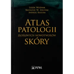 ATLAS PATOLOGII ZŁOŚLIWYCH NOWOTWORÓW SKÓRY